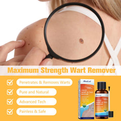 URSEORY Packaging—clear instructions for safe, home-based wart removal.