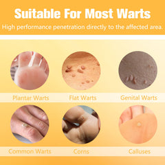 URSEORY Skin Tag Remover fine-tip applicator—precise application to isolated wart.