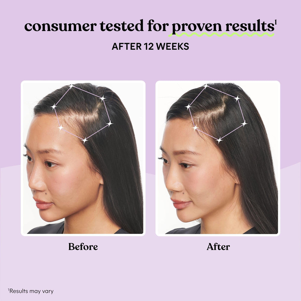 Graphic showing results in 30 days for hair growth