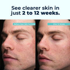 Key ingredients: vitamins A, C, E, zinc, selenium, and chromium