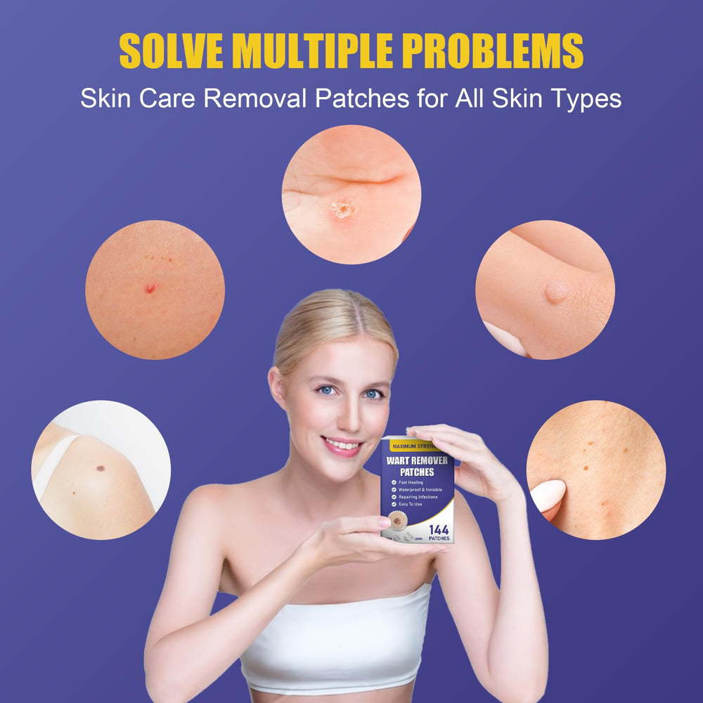 WABRINY wart remover patch skin-tone closeup showcases gentle formula