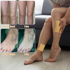 Close-up of turmeric varicose vein patch texture