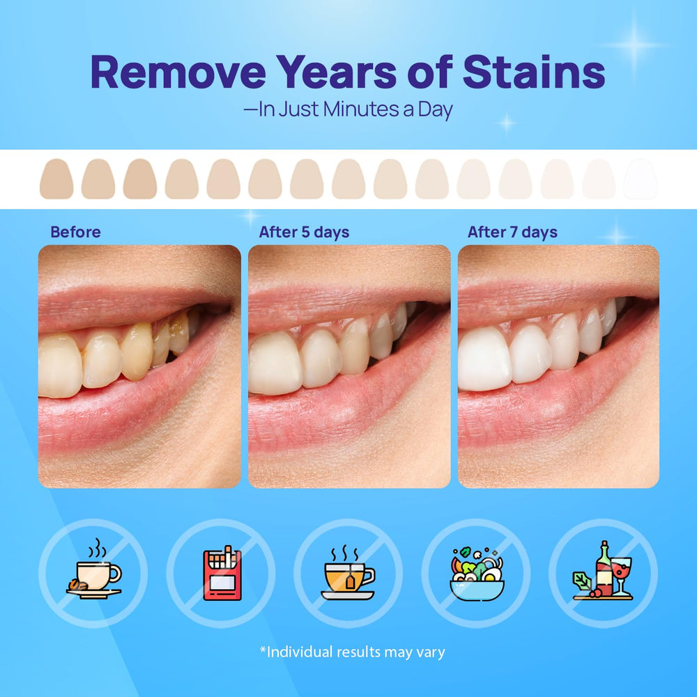 Gentle whitening formula suitable for sensitive teeth