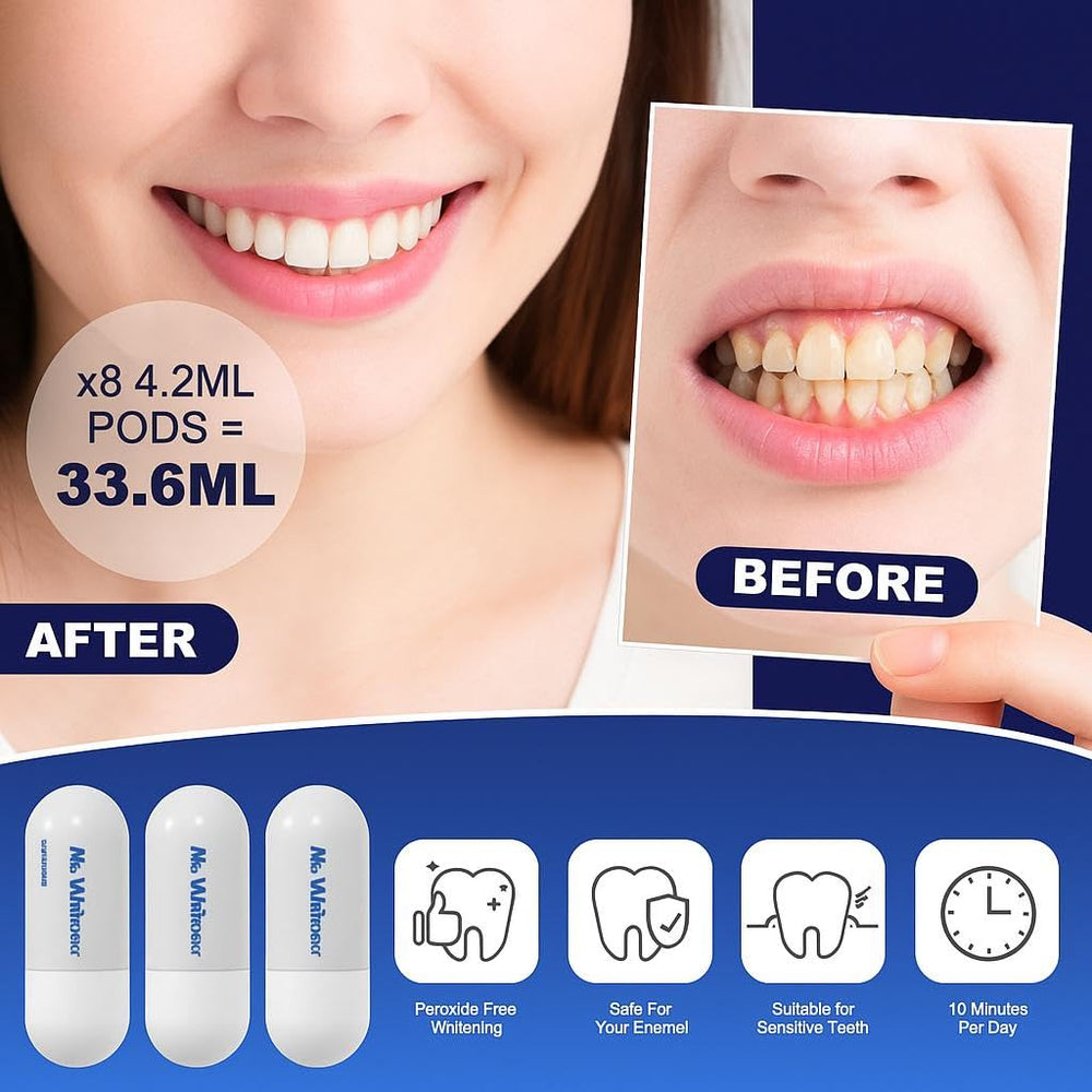Eight 4.2ml whitening gel pods (total 33.6ml)