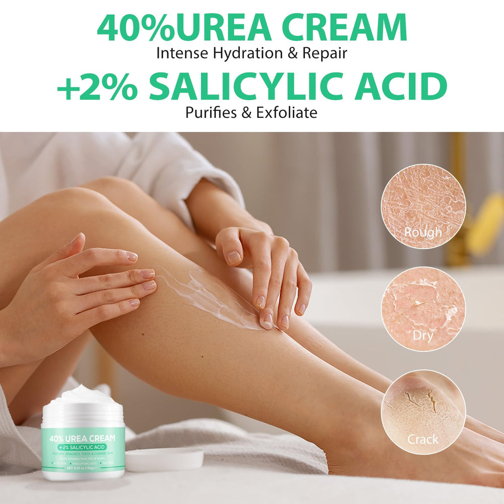 XIAMOFUZHOU Urea 40% smooth application on rough feet.