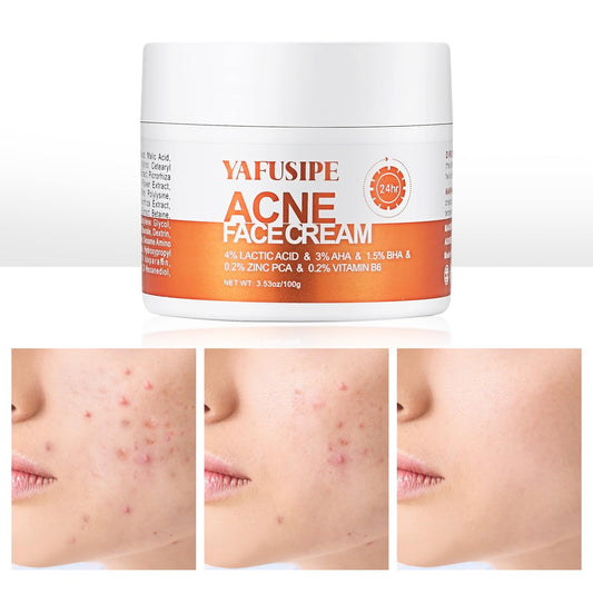 YAFUSIPE acne treatment cream tube for targeted breakout care