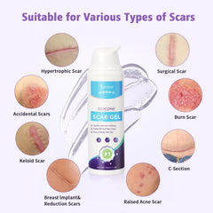 Yarster scar gel packaging features compact bottle
