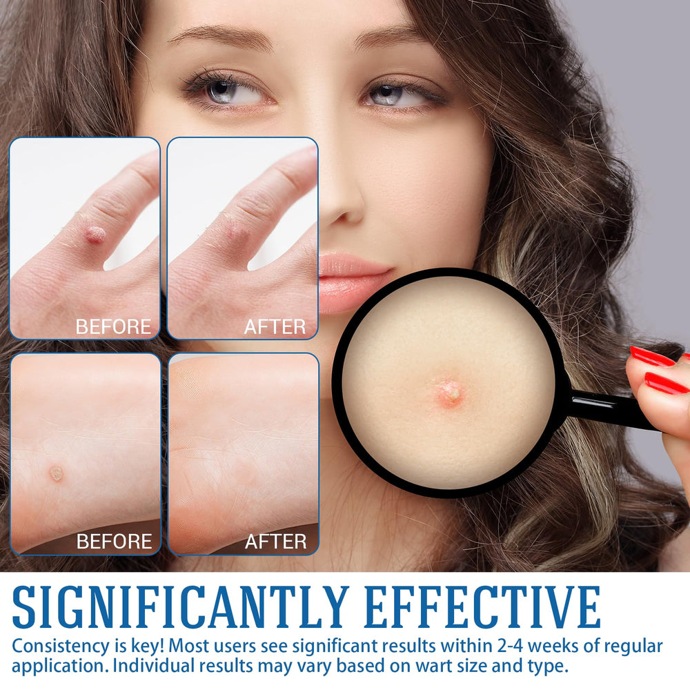 YEHOYOD gentle non-irritating formula shown for sensitive skin types.
