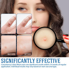 YEHOYOD gentle non-irritating formula shown for sensitive skin types.