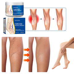 Yetary varicose veins cream for legs application demonstrating massage motion.