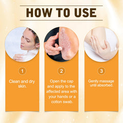 YIVANNUO Bee Venom Cream suitable for sensitive skin with gentle ingredients