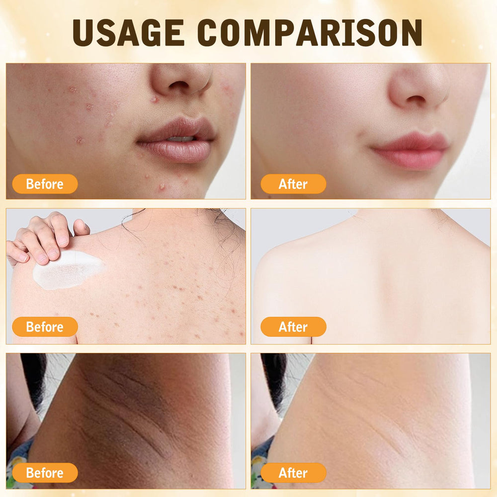 YIVANNUO Bee Venom Cream provides a natural glow through deep moisturization