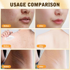 YIVANNUO Bee Venom Cream provides a natural glow through deep moisturization