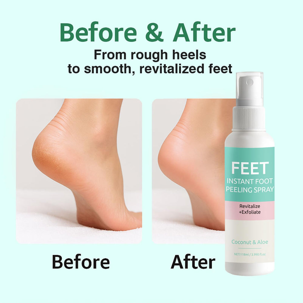 Boxed Yunmeng Instant Foot Peeling Mask Spray package on a surface