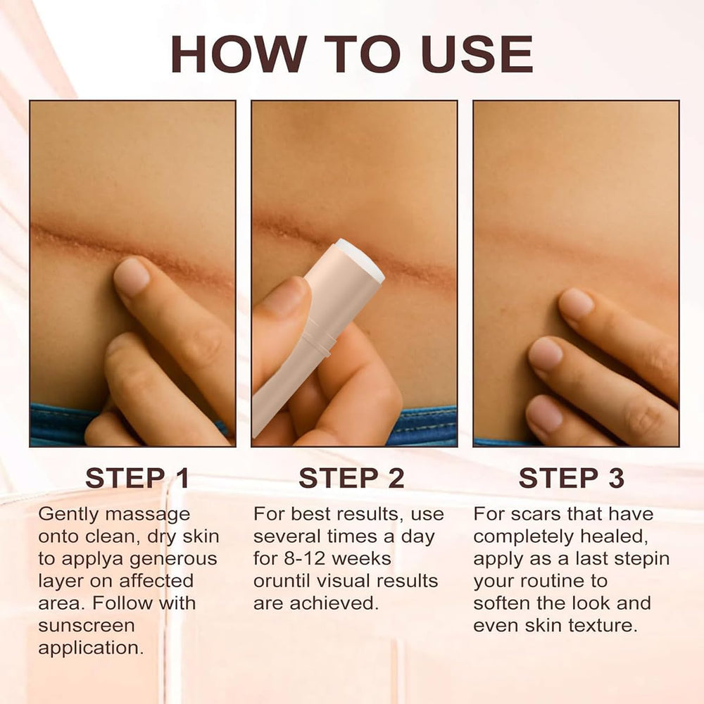 ZanDVRum Scar Solutions Stick gentle formula for sensitive skin.