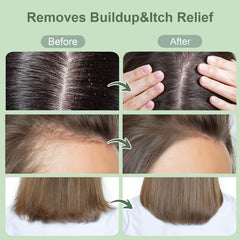 ZENGYQI exfoliating scrub application demonstrates a 2-3 minute scalp massage.