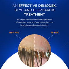 Zocular Zocuwipe eyelid refresh result implies refreshed eyes after cleansing