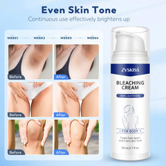 ZVSKISS Skin Bleaching Cream on underarms promoting even tone and gentle care