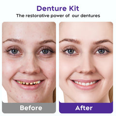 Temporary tooth replacement kit for natural look