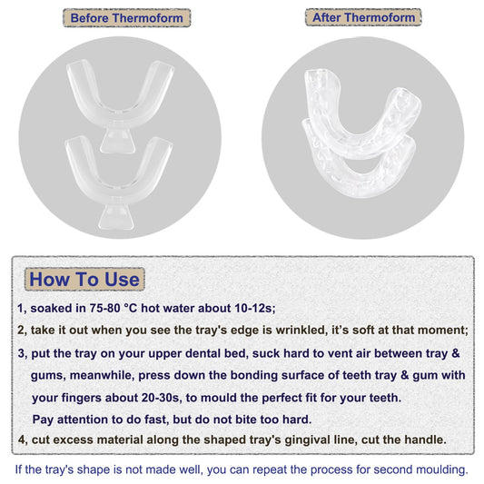 Adult BPA-free teeth whitening tray kit