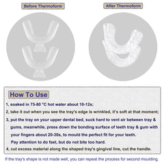 Adult BPA-free teeth whitening tray kit