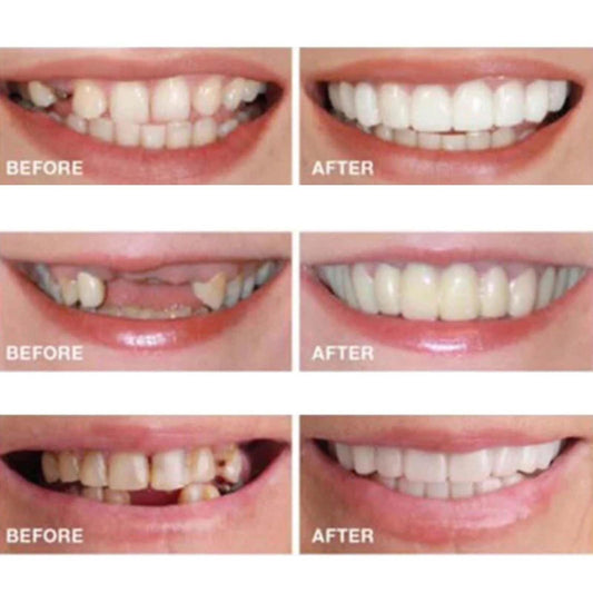 User adjusting the white smile tray to fit