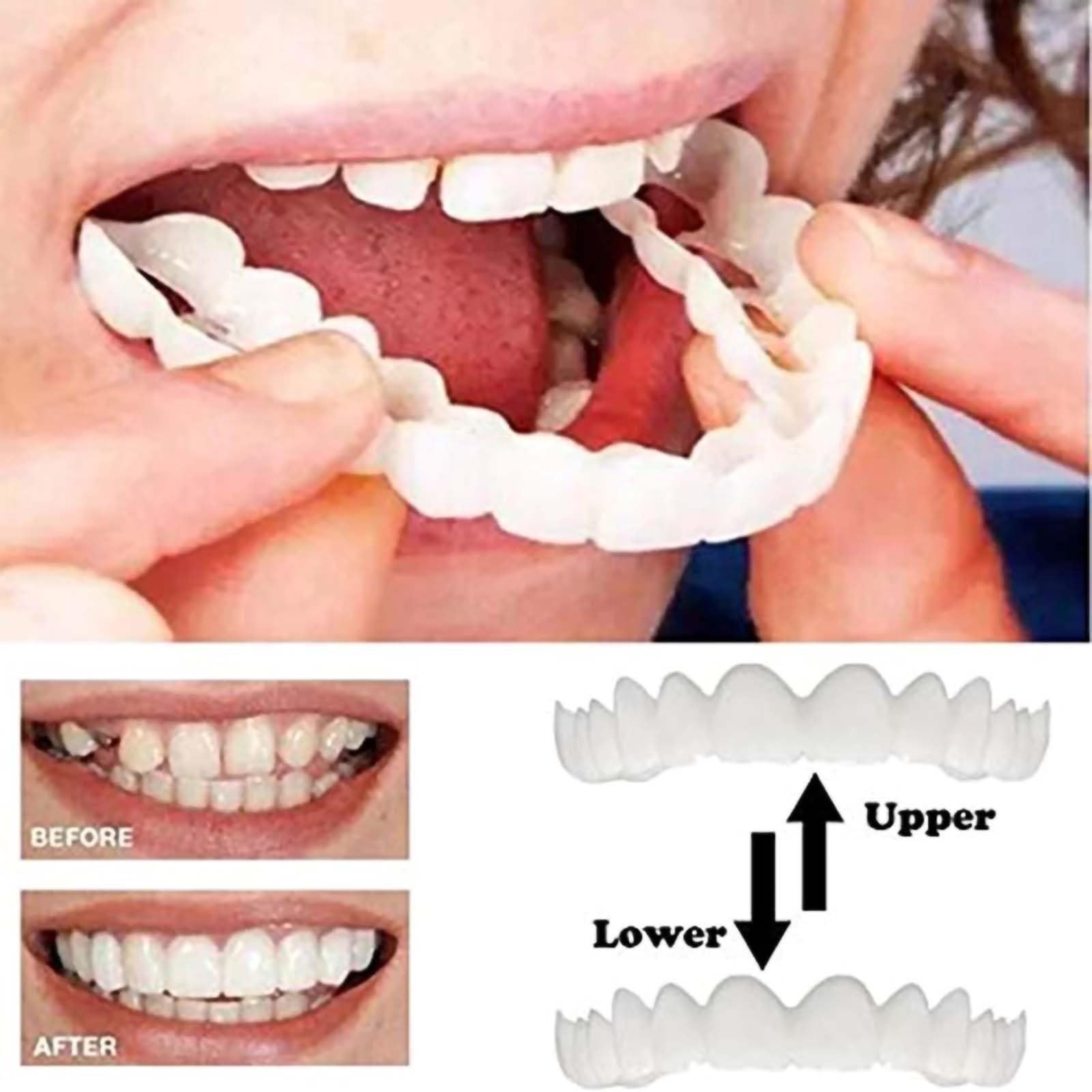 Close-up of natural white colour smile tray