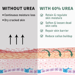 60% Urea Cream on elbows and knees for moisturized, smoother skin