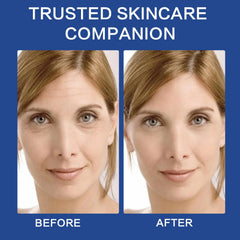 ABOTE serum on face closeup hints at a refreshed look