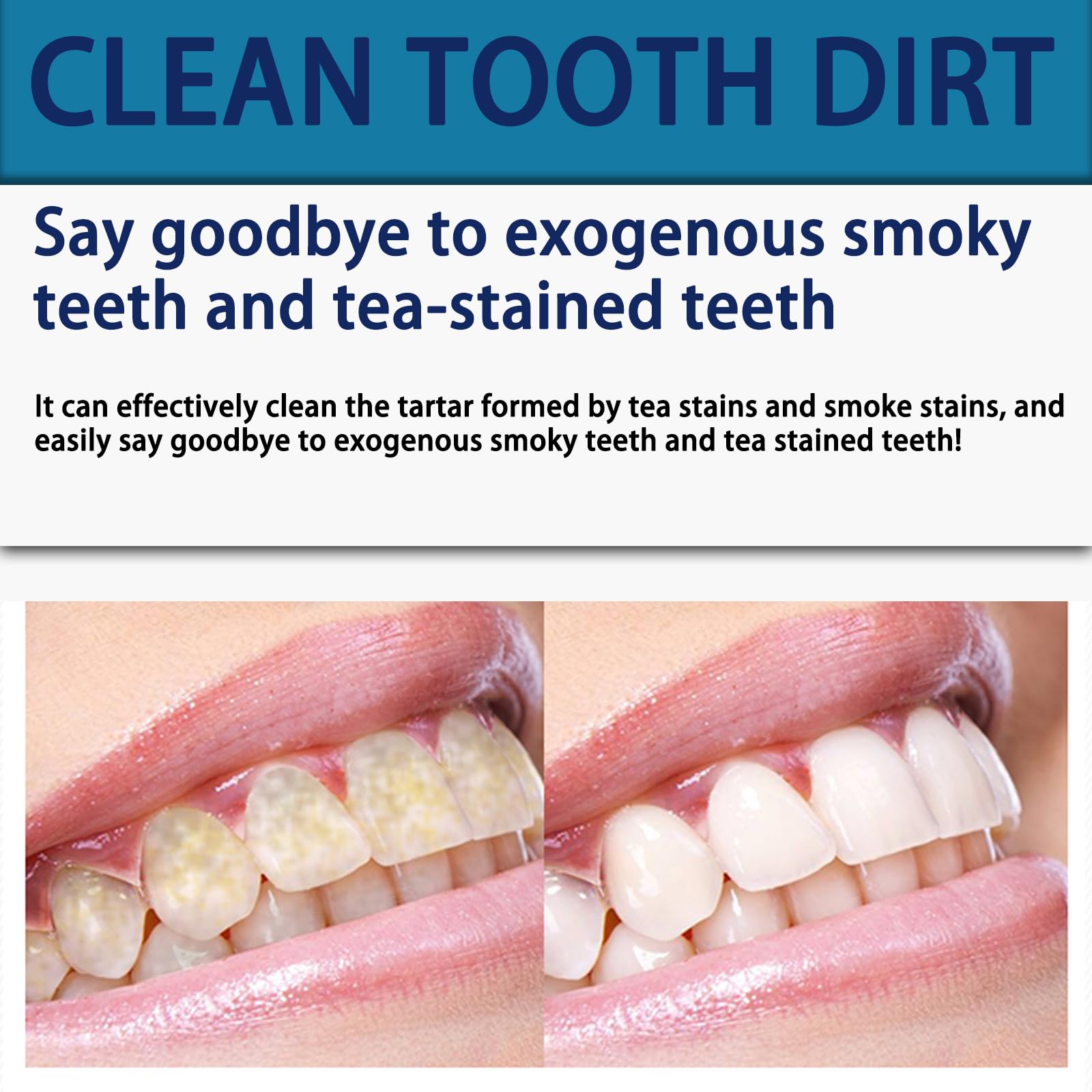ABYST packaging for Diamond Dissolving Teeth Whitening Strips