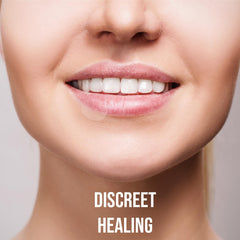 Acculip lip patch worn under makeup for cosmetic-friendly coverage