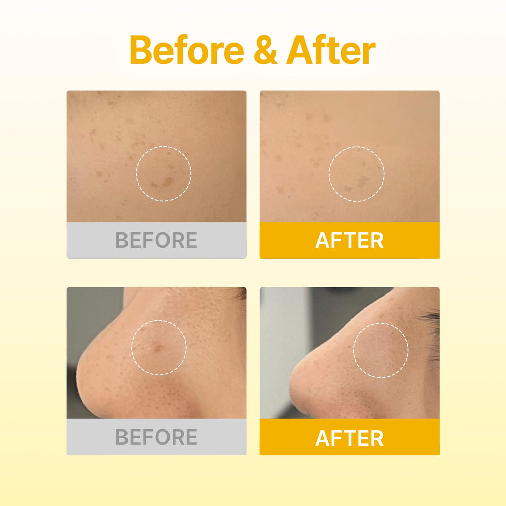 Acropass dermatologist-tested badge indicates safety and efficacy focus.