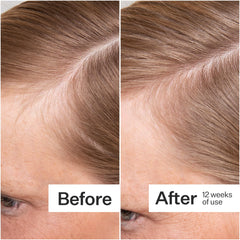 Biotin and Vitamin C to support hair health