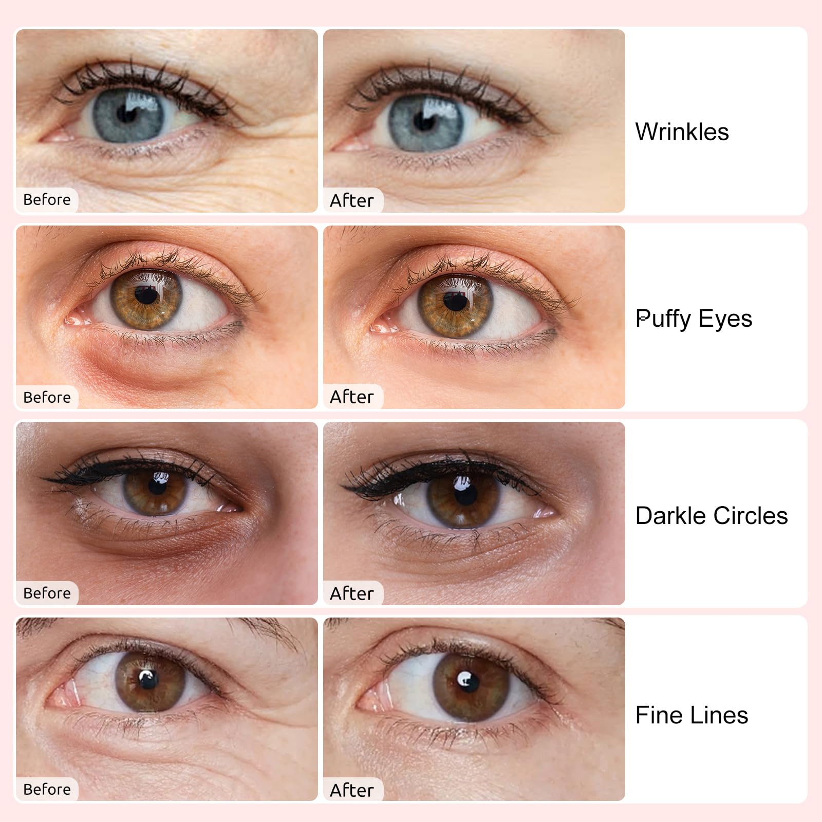 Adofect under eye patches blue pack for firmer, smoother eye area