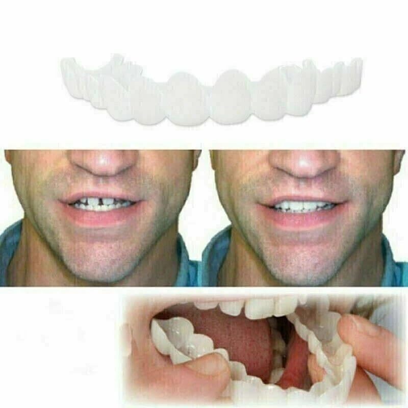 Adult-friendly temporary smile makeover kit