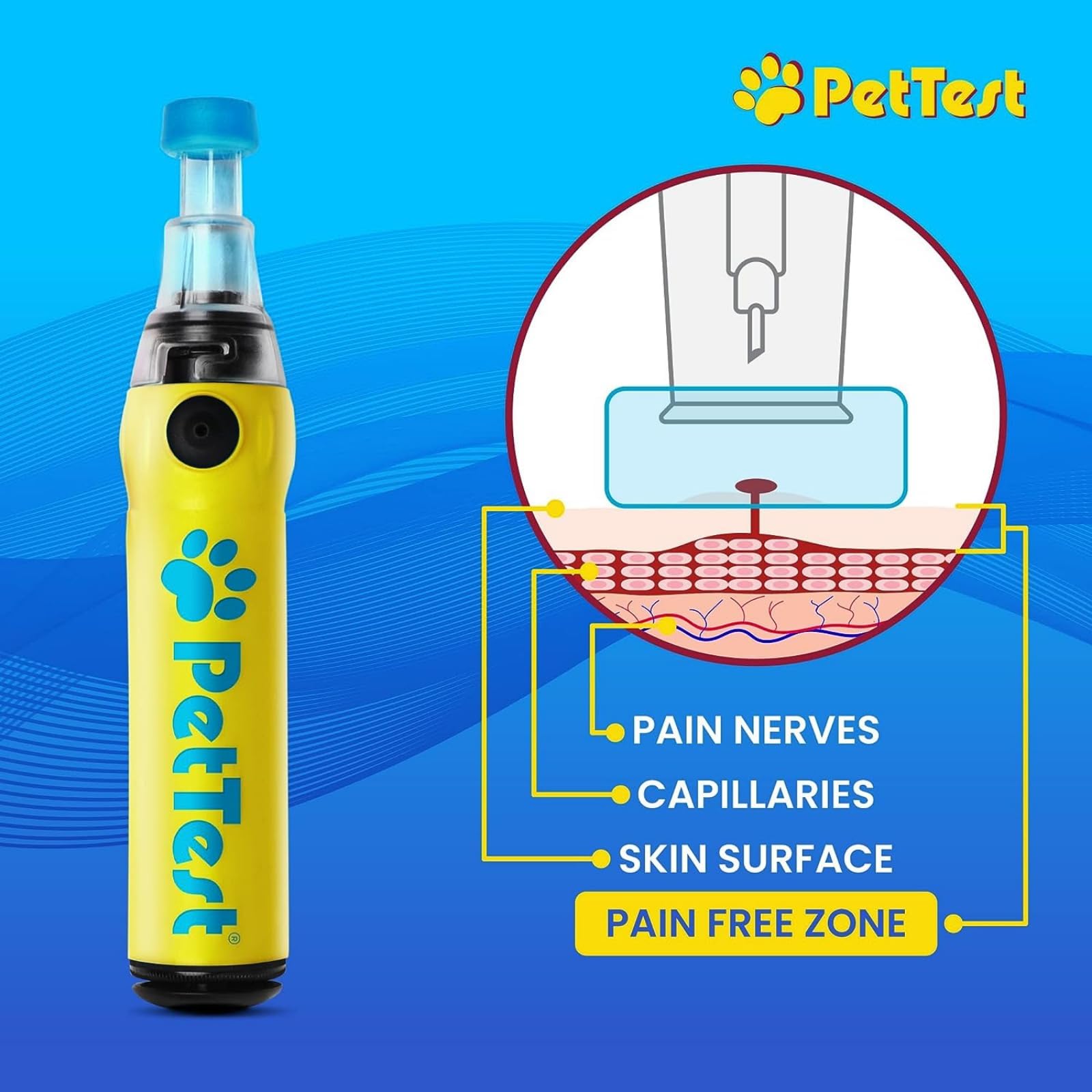 Advocate PetTest Genteel lancing device delivers comfortable, pain-free sampling