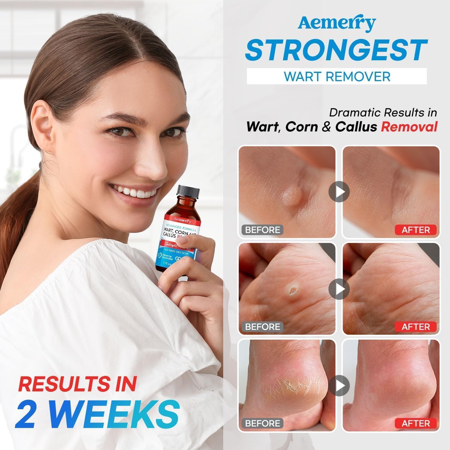 Aemerry safe-and-natural formula protects surrounding skin during use.