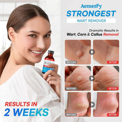 Aemerry safe-and-natural formula protects surrounding skin during use.