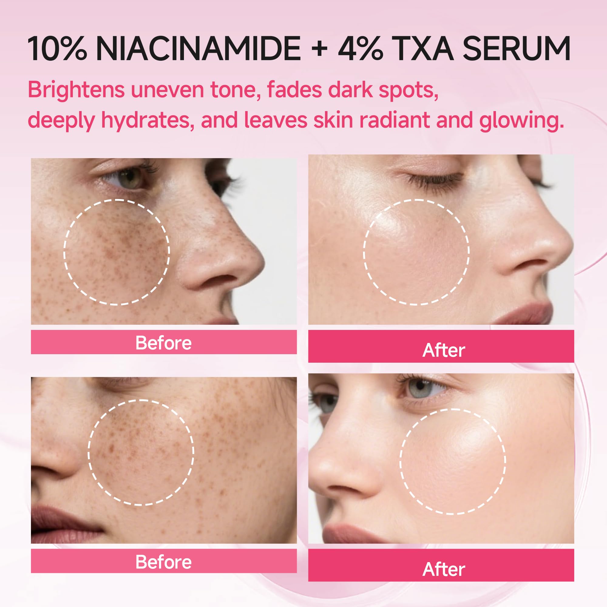 AEMRTJG Niacinamide TXA serum included in daily routine for hydration
