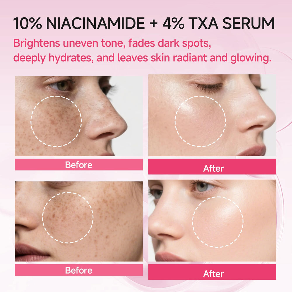 AEMRTJG Niacinamide TXA serum included in daily routine for hydration