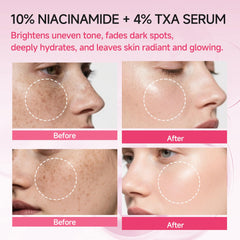 AEMRTJG Niacinamide TXA serum included in daily routine for hydration