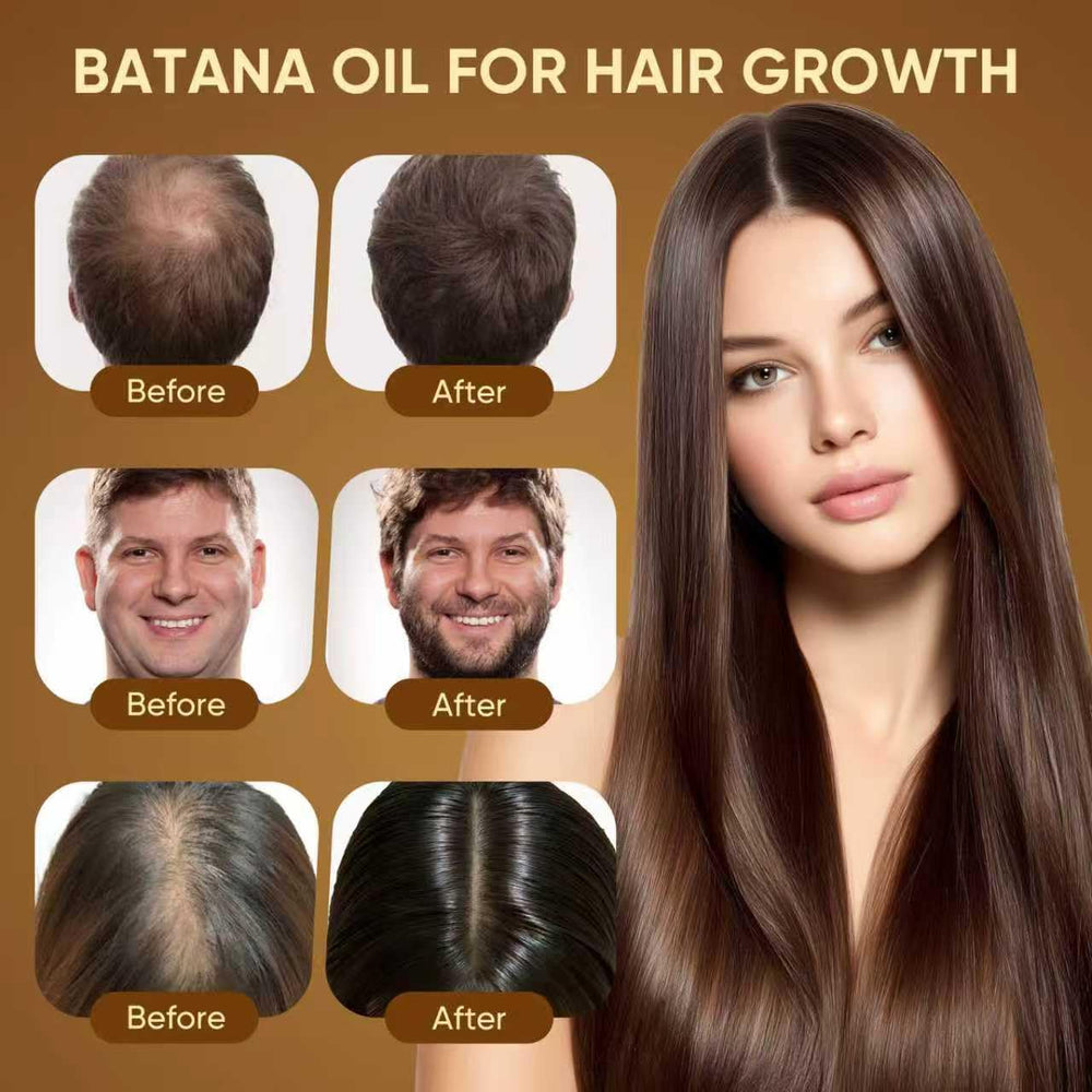 Scalp massage focus using Agodafoo Batana Oil promotes circulation and balance.