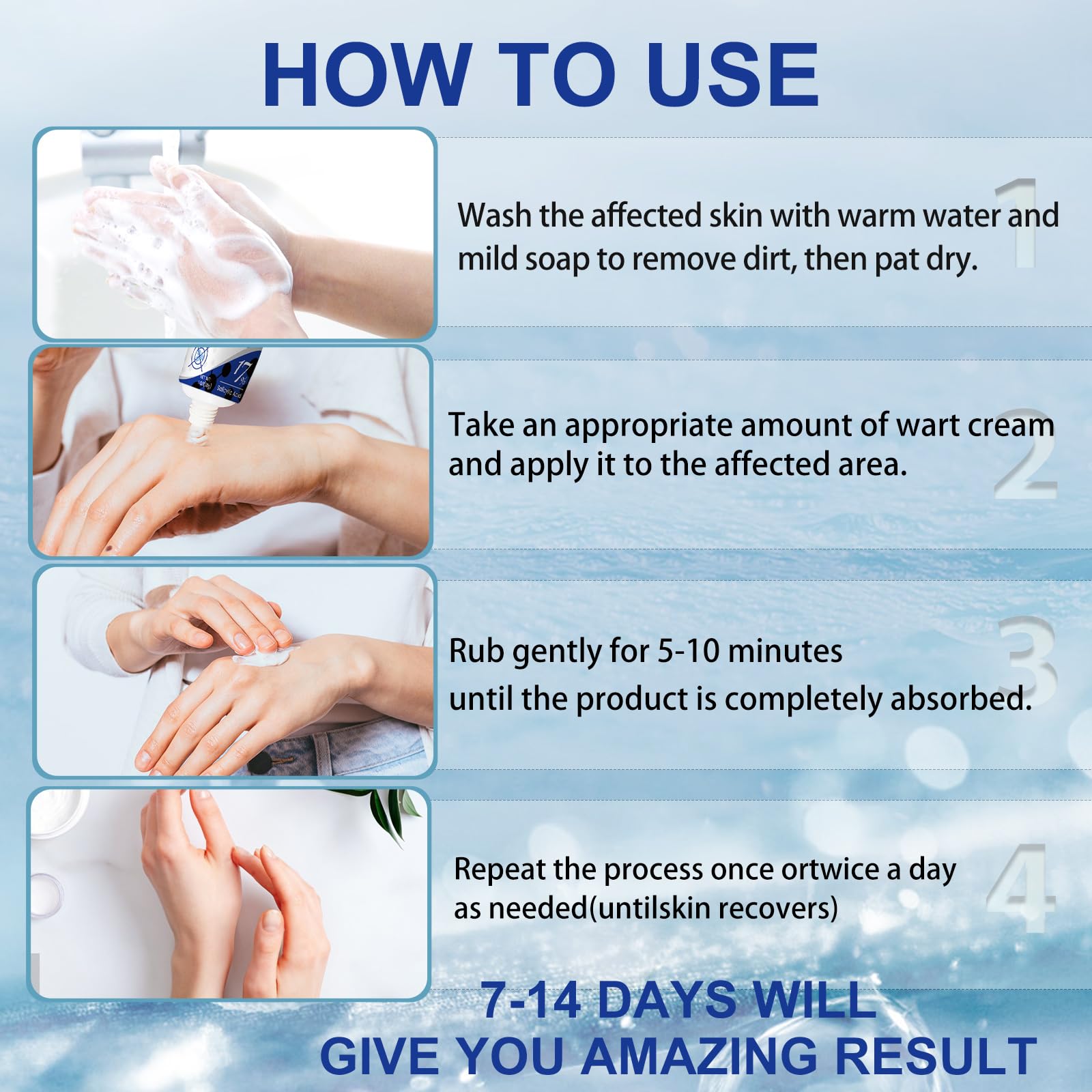 AHUIFT genital wart focus demonstrates suitability for sensitive wart types