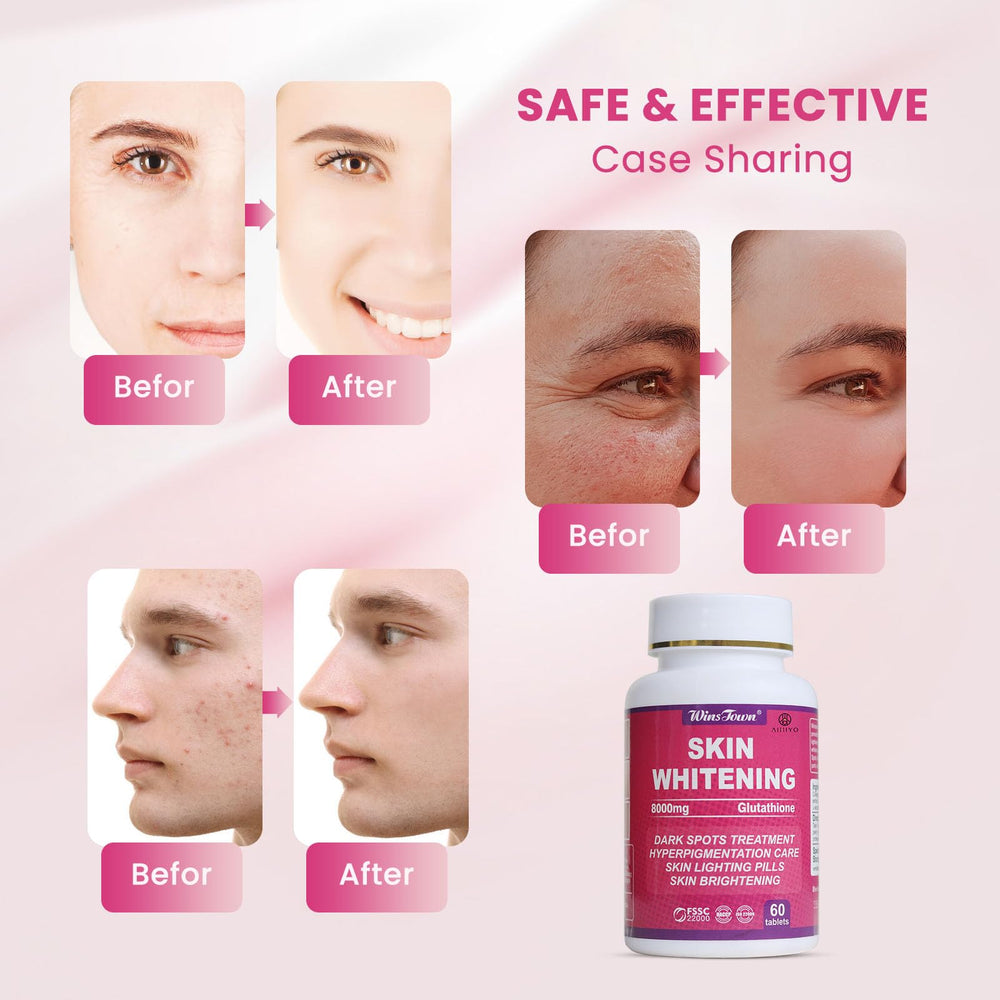 AIHIYO pill aiding acne scar improvement