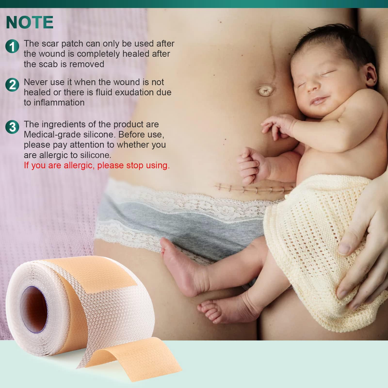 AirroYE silicone scar sheets for burns and surgical scars
