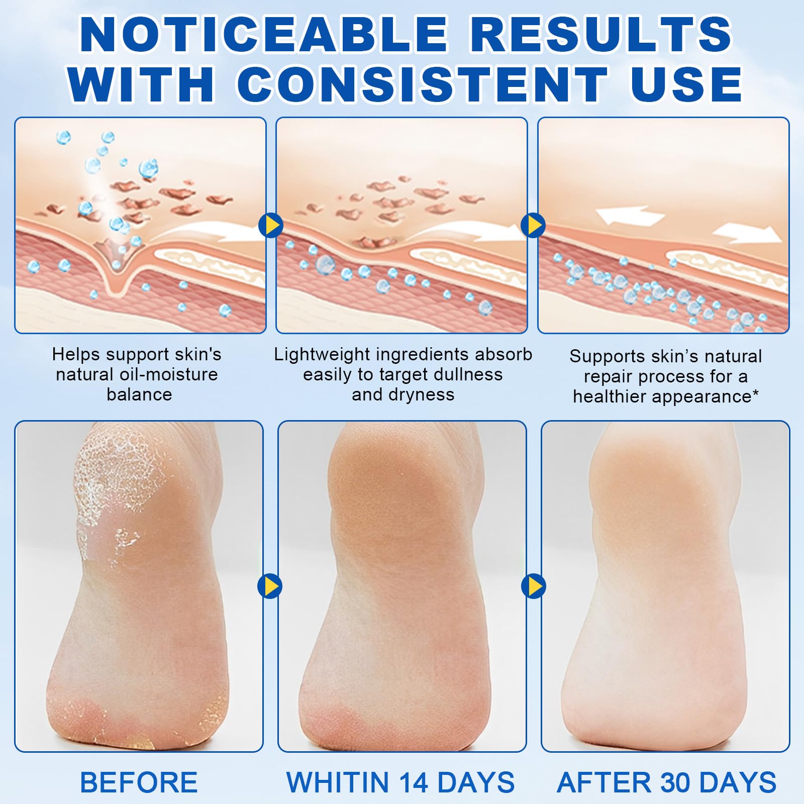 Alstaky 60% urea and 2% salicylic acid foot stick action