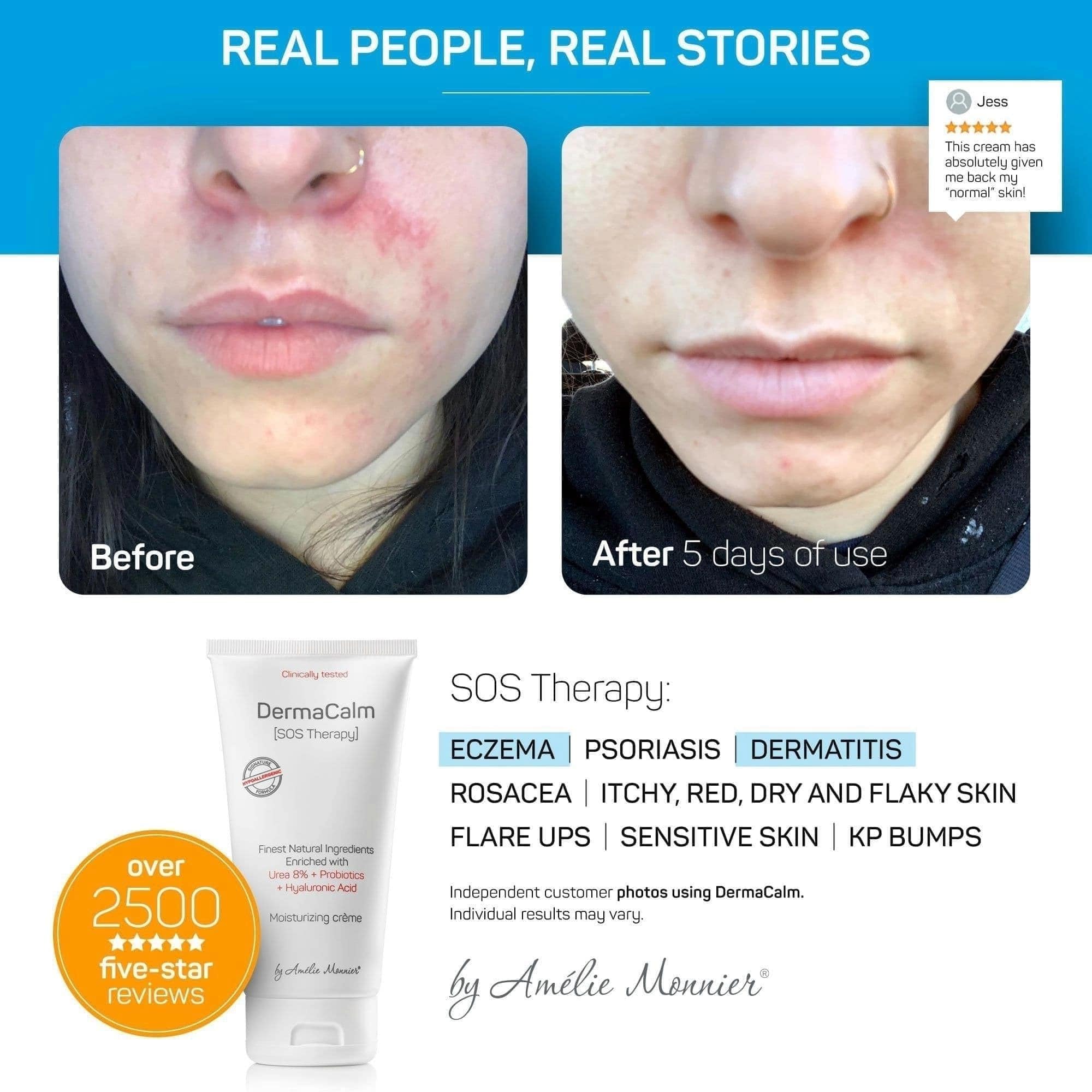 Cream texture showing rich moisturizing blend with urea and hyaluronic acid