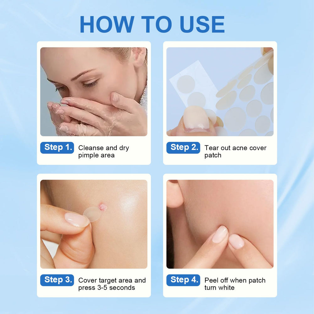 Amouy face patch ideal for quick, discreet blemish care on the go.