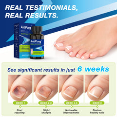 AntiFung nail-care routine setup depicts simple daily care steps
