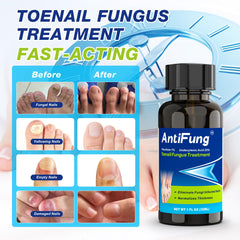 AntiFung tea tree oil blend highlights natural antifungal power for nails